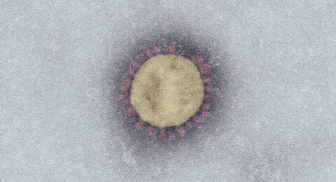 SARS-Coronavirus-2. Scale bar: 100 nm.